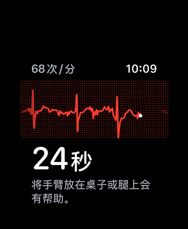 移动心电图房颤提示软件，屏幕左上角显示每分钟心跳次数，另有心律线和计时器。