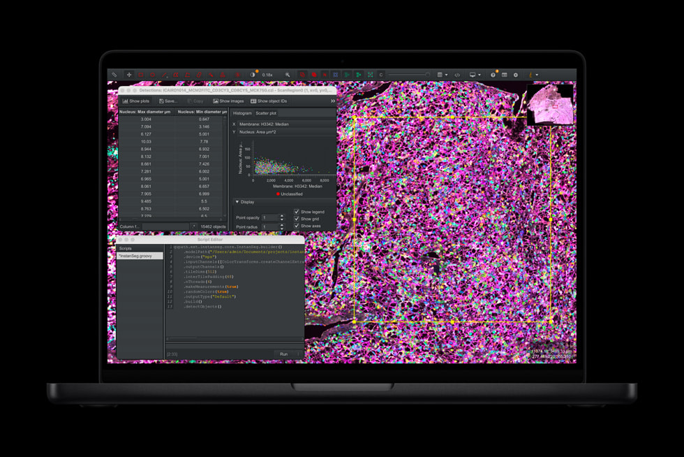 MacBook Pro 上显示着 QuPath 界面。