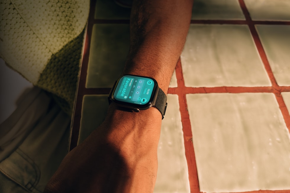 图中是一名用户的手臂特写，展示着手腕上佩戴的 Apple Watch Series 12。