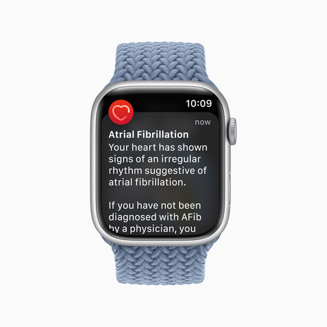 Apple Watch Series 8 的房颤心律失常通知。