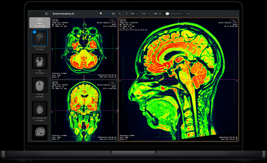 MacBook Pro 屏幕展示 Falcon MD app 界面