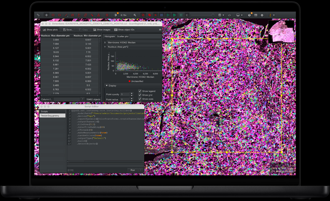 MacBook Pro 屏幕展示 QuPath 和 Instanseg。